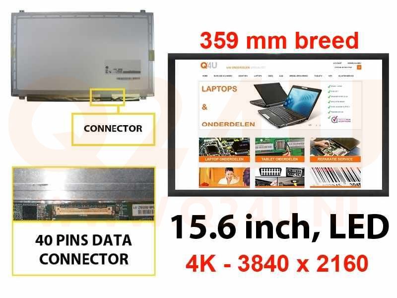 Scherm 15.6 inch, 4K 3840 x 2160, LTN156FL06-301 - Glanzend- 359 mm breed